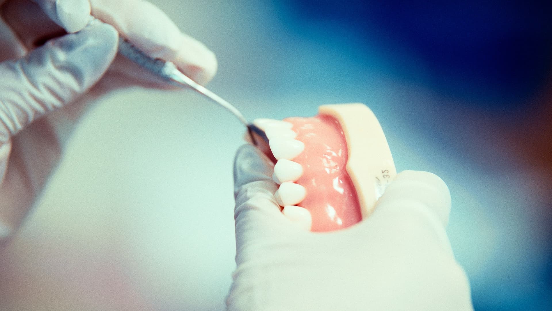 Manos con guantes trabajando sobre un modelo dental